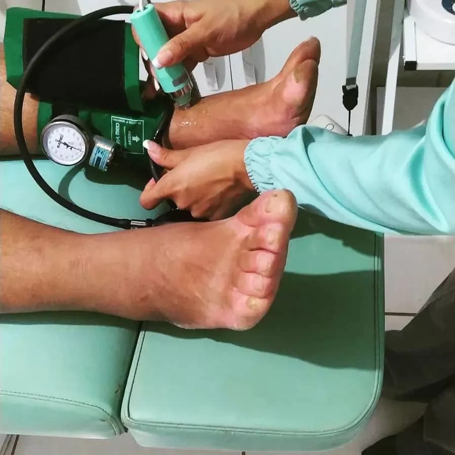 Avaliação dos pés com manguito no tornozelo e aparelho portátil
